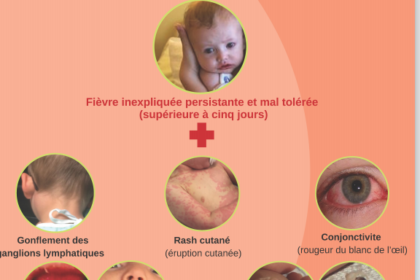 maladie de kawasaki