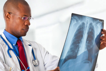 La tuberculose est une maladie infectieuse qui affecte le plus souvent les poumons. Elle est causée par un type de bactérie qui se propage dans l'air lorsque les personnes infectées toussent, éternuent ou crachent.