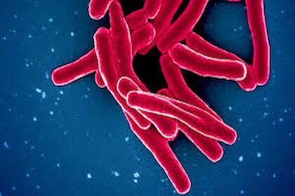 Cas de tuberculose à Nabeul