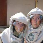 malades de Xeroderma Pigmentosum