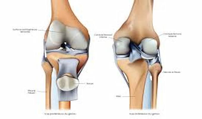 L'usure du cartilage du genou